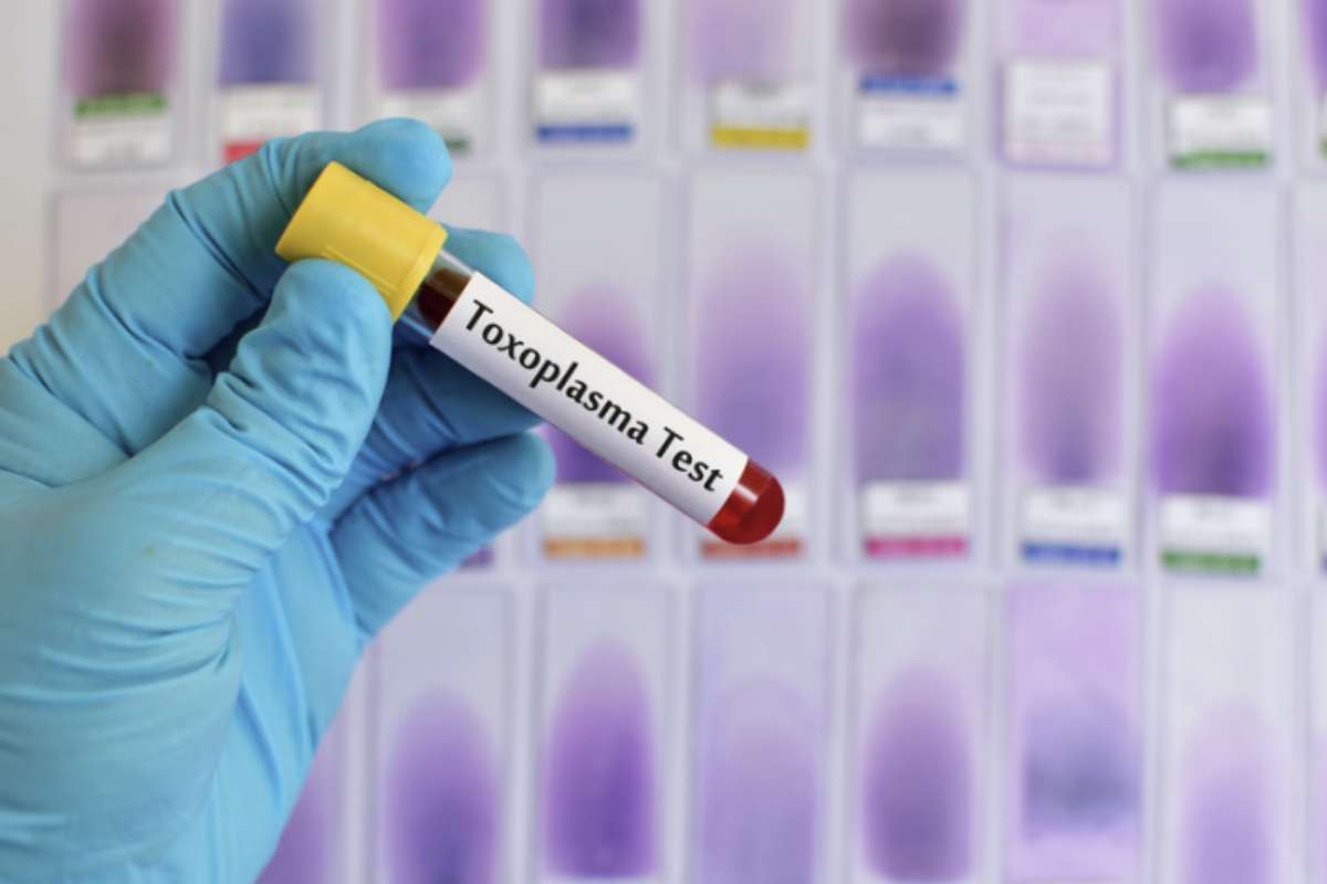 Una delle peculiarità più sorprendenti di Toxoplasma è la sua capacità di alterare la risposta immunitaria dell'ospite.