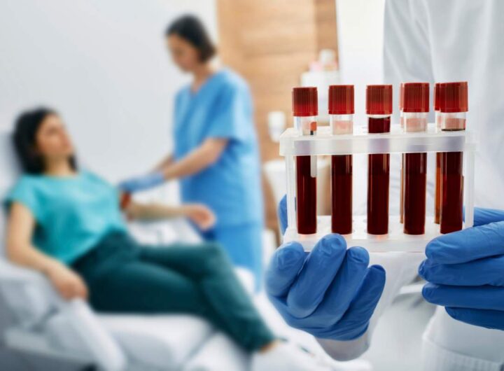 Esami del sangue