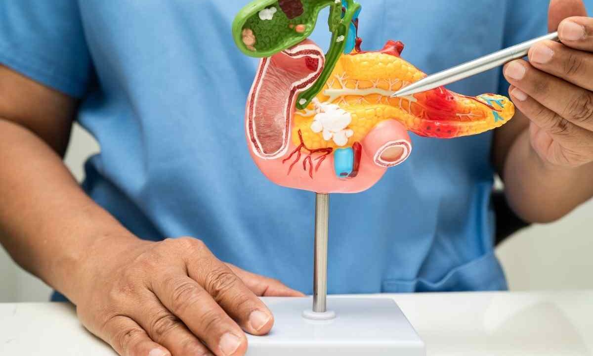 Tumore al pancreas ecco a cosa fare attenzione