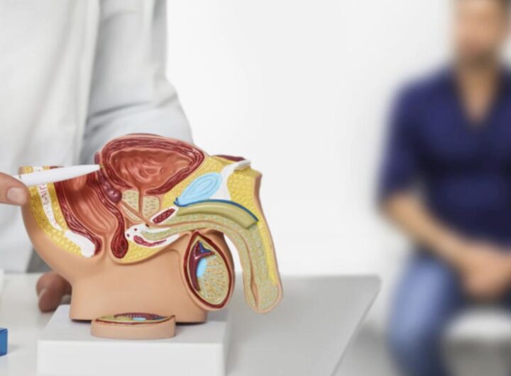 Nonostante i controlli regolari e approfonditi, la forma particolarmente aggressiva del cancro